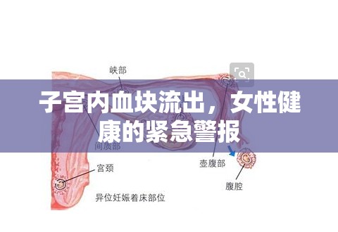 子宮內(nèi)血塊流出，女性健康的緊急警報(bào)