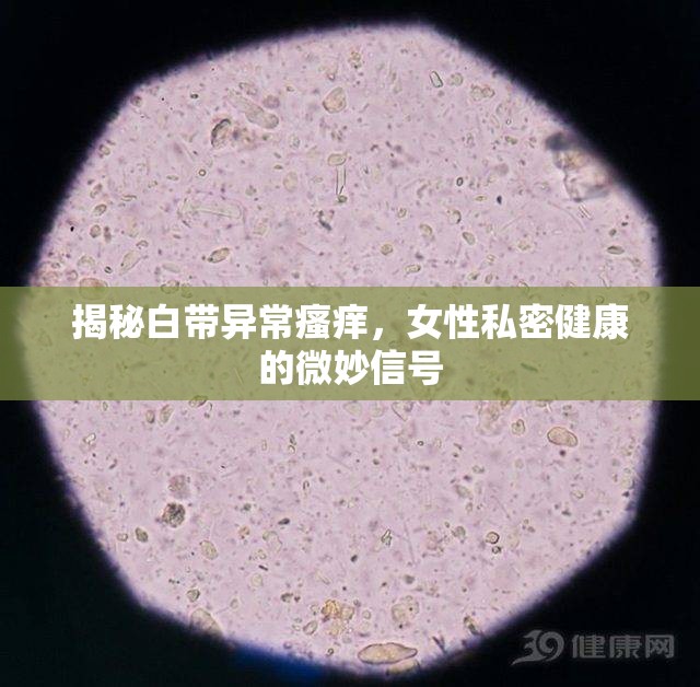 揭秘白帶異常瘙癢，女性私密健康的微妙信號