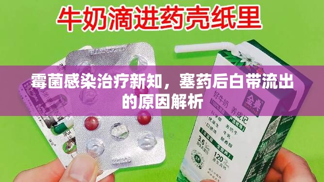 霉菌感染治療新知，塞藥后白帶流出的原因解析