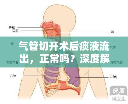 氣管切開術(shù)后痰液流出，正常嗎？深度解析與護(hù)理指南