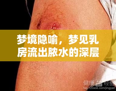 夢境隱喻，夢見乳房流出膿水的深層含義與心理解析