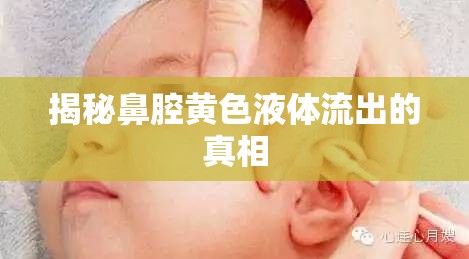 揭秘鼻腔黃色液體流出的真相