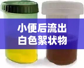 小便后流出白色絮狀物，健康警報還是日常小困擾？