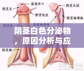 陰莖白色分泌物，原因分析與應(yīng)對(duì)措施