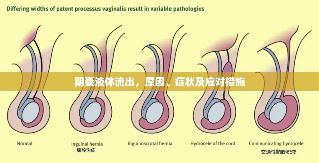 陰囊液體流出，原因、癥狀及應(yīng)對措施