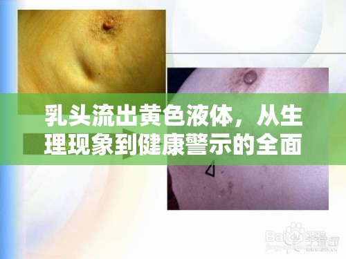 乳頭流出黃色液體，從生理現(xiàn)象到健康警示的全面解析