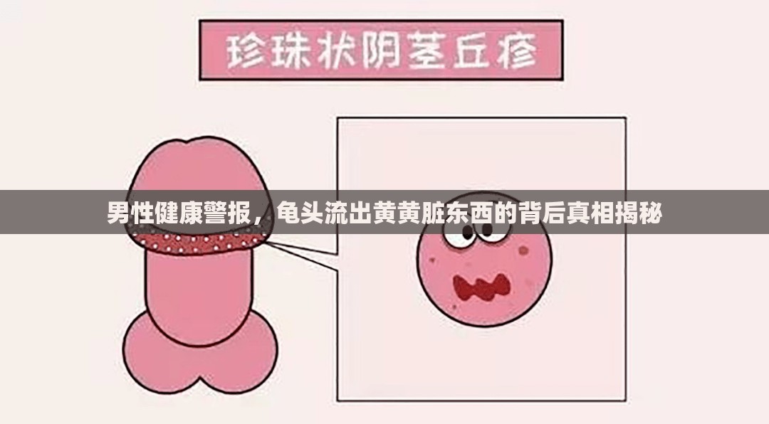 男性健康警報，龜頭流出黃黃臟東西的背后真相揭秘