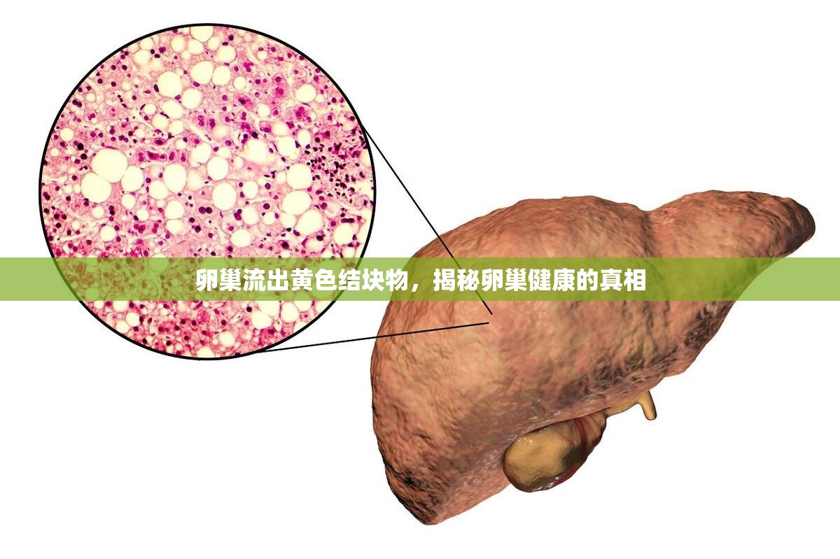 卵巢流出黃色結(jié)塊物，揭秘卵巢健康的真相