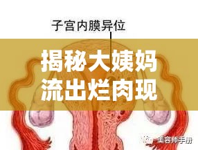 揭秘大姨媽流出爛肉現象，真相與應對策略