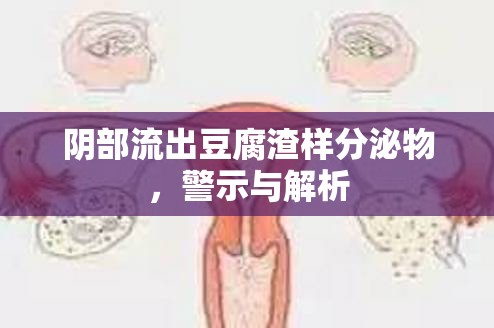 陰部流出豆腐渣樣分泌物，警示與解析