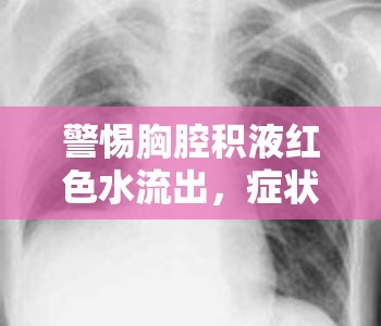 警惕胸腔積液紅色水流出，癥狀、原因與應對策略