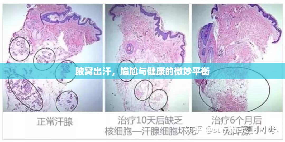 腋窩出汗，尷尬與健康的微妙平衡