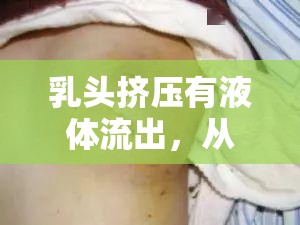 乳頭擠壓有液體流出，從生理現(xiàn)象到健康警報的全面探索