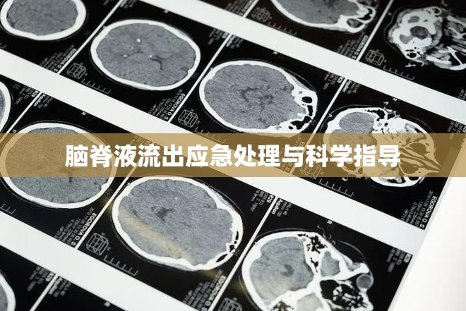 腦脊液流出應急處理與科學指導