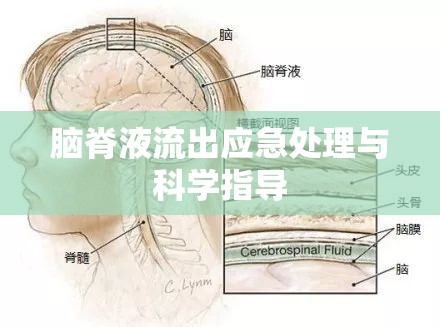 腦脊液流出應急處理與科學指導