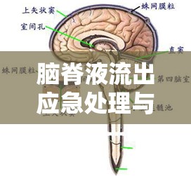 腦脊液流出應急處理與科學指導