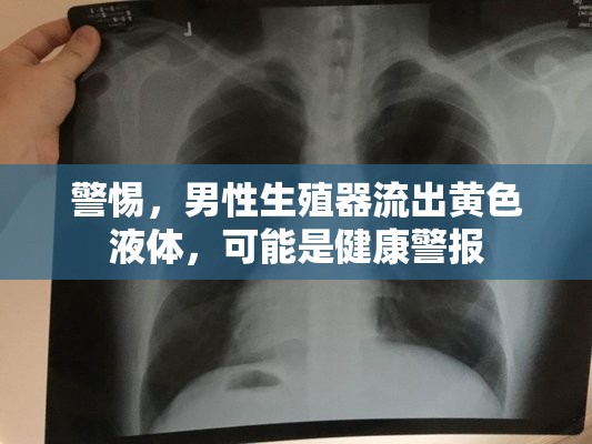 警惕，男性生殖器流出黃色液體，可能是健康警報