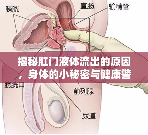 揭秘肛門(mén)液體流出的原因，身體的小秘密與健康警報(bào)