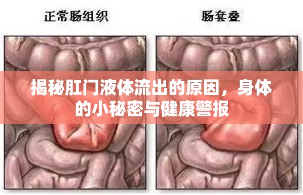 揭秘肛門液體流出的原因，身體的小秘密與健康警報