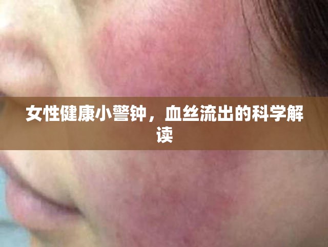 女性健康小警鐘，血絲流出的科學解讀