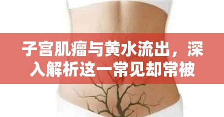 子宮肌瘤與黃水流出，深入解析這一常見卻常被忽視的警示信號