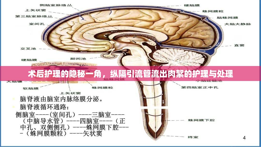 術(shù)后護理的隱秘一角，縱隔引流管流出肉絮的護理與處理