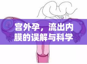 宮外孕，流出內(nèi)膜的誤解與科學(xué)真相