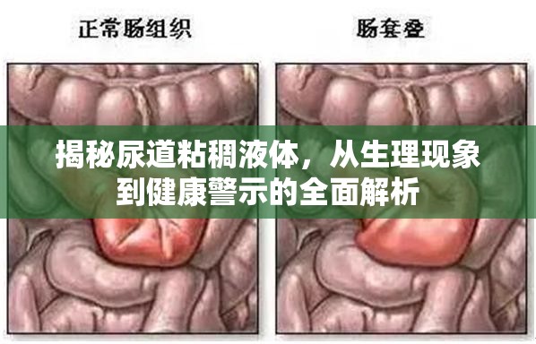 揭秘尿道粘稠液體，從生理現(xiàn)象到健康警示的全面解析