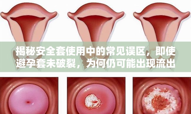 揭秘安全套使用中的常見誤區(qū)，即使避孕套未破裂，為何仍可能出現(xiàn)流出現(xiàn)象？