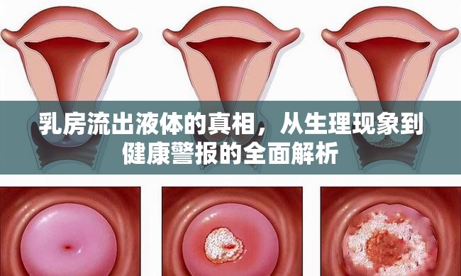 乳房流出液體的真相，從生理現(xiàn)象到健康警報的全面解析