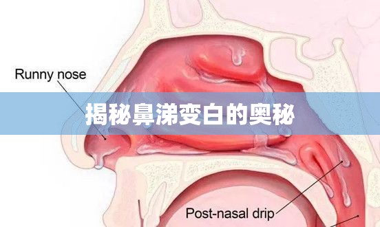 揭秘鼻涕變白的奧秘