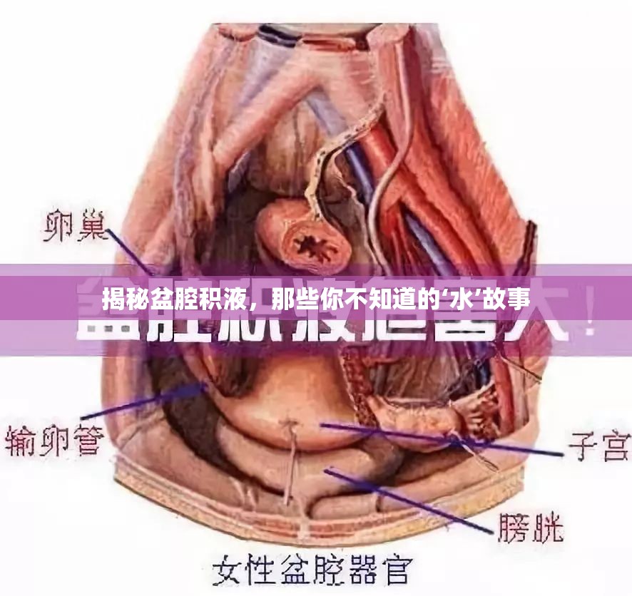 揭秘盆腔積液，那些你不知道的‘水’故事