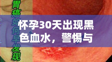 懷孕30天出現(xiàn)黑色血水，警惕與應對的全面指南