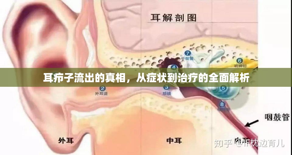 耳癤子流出的真相，從癥狀到治療的全面解析