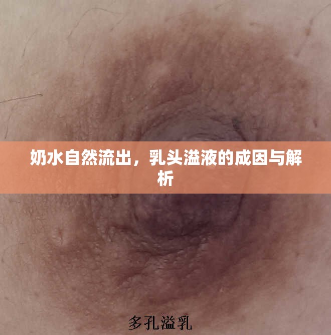 奶水自然流出，乳頭溢液的成因與解析