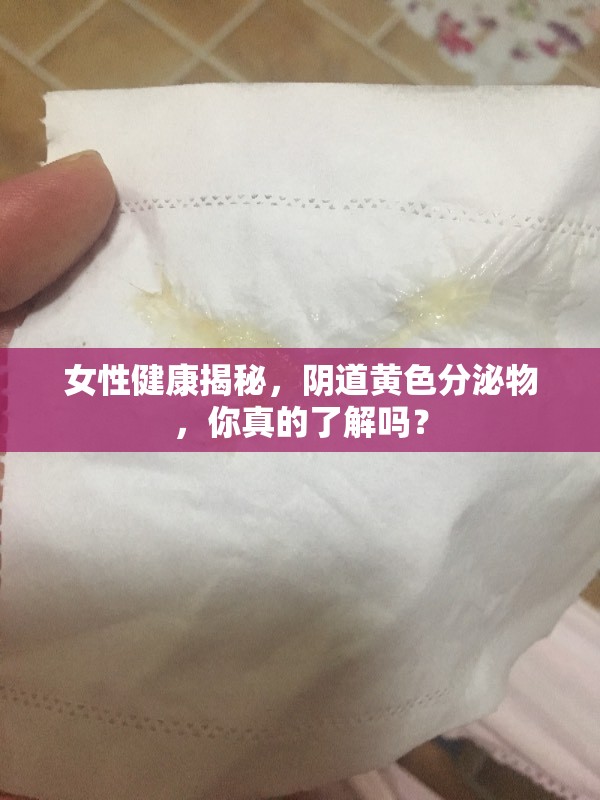 女性健康揭秘，陰道黃色分泌物，你真的了解嗎？