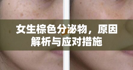 女生棕色分泌物，原因解析與應(yīng)對措施