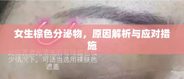 女生棕色分泌物，原因解析與應(yīng)對(duì)措施