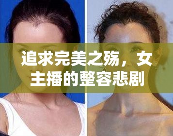 追求完美之殤，女主播的整容悲劇