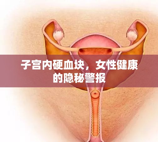 子宮內(nèi)硬血塊，女性健康的隱秘警報(bào)