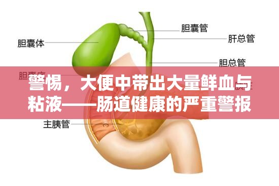 警惕，大便中帶出大量鮮血與粘液——腸道健康的嚴重警報