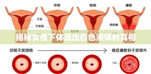 揭秘女性下體流出白色液體的真相