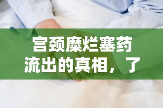 宮頸糜爛塞藥流出的真相，了解、應(yīng)對(duì)與日常護(hù)理指南