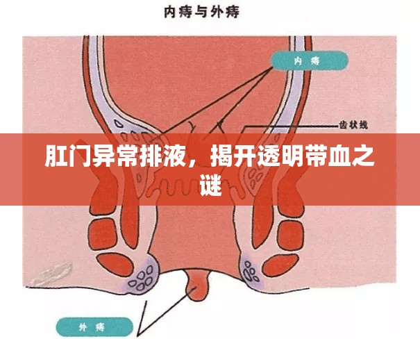 肛門異常排液，揭開透明帶血之謎