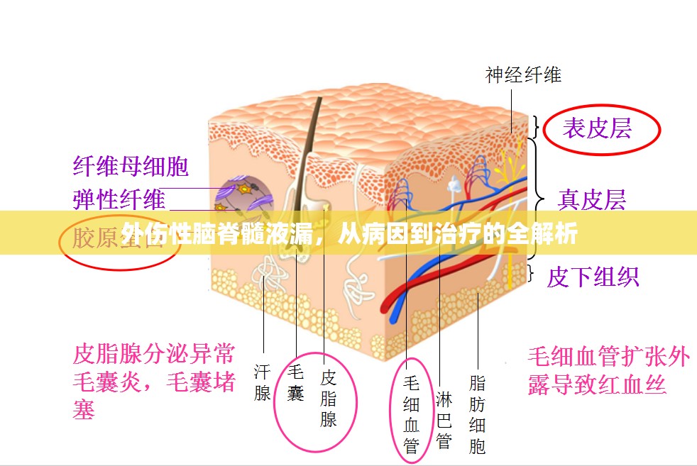 外傷性腦脊髓液漏，從病因到治療的全解析