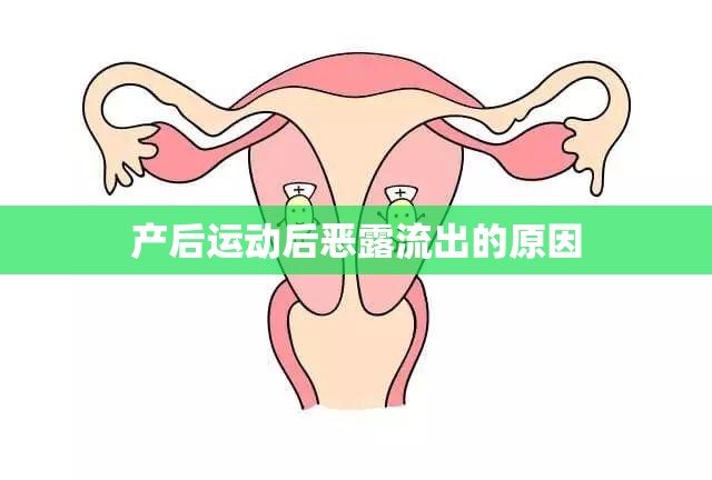 產(chǎn)后運(yùn)動后惡露流出的原因