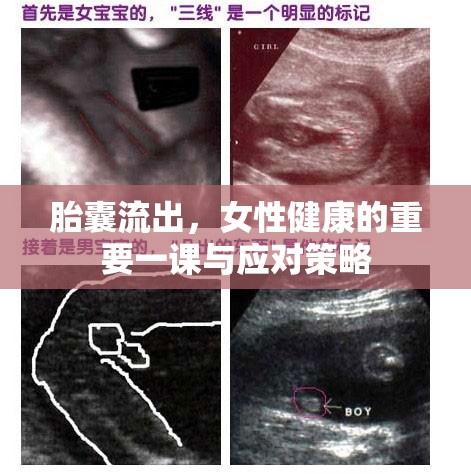 胎囊流出，女性健康的重要一課與應(yīng)對策略