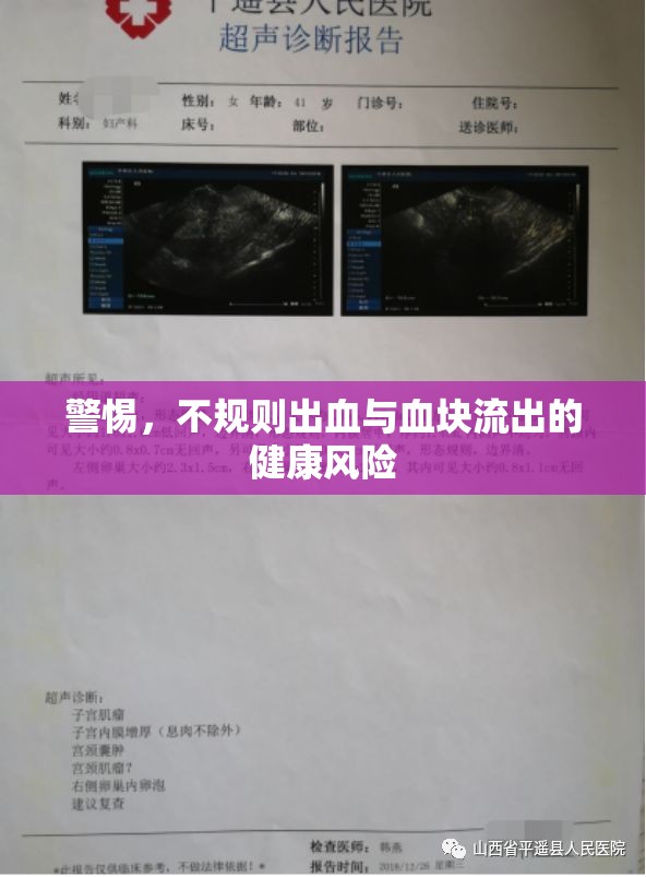 警惕，不規(guī)則出血與血塊流出的健康風險