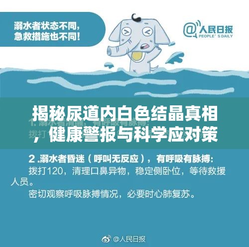 揭秘尿道內(nèi)白色結(jié)晶真相，健康警報與科學應對策略