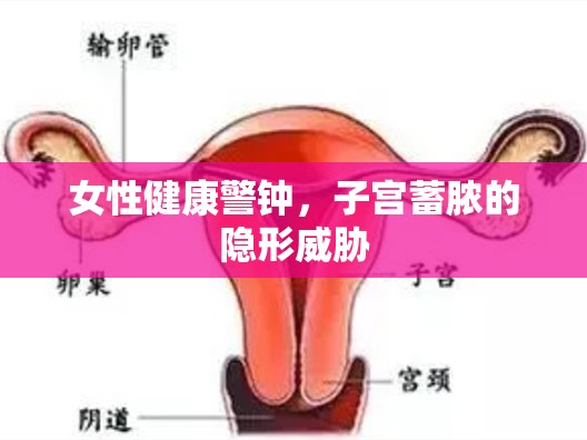 女性健康警鐘，子宮蓄膿的隱形威脅